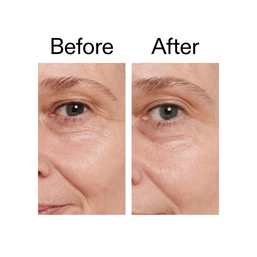 The INKEY List Retinol Eye Cream - 15ml - Image 4